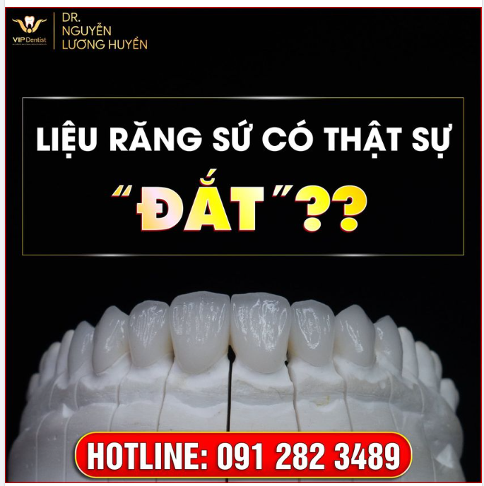 LIỆU RĂNG SỨ CÓ THẬT SỰ "ĐẮT"