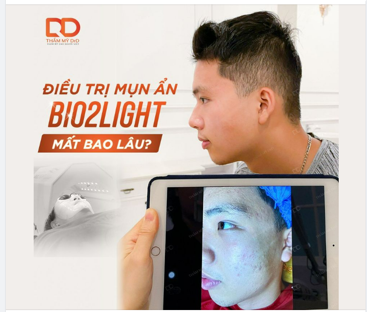 LIỆU TRÌNH ĐIỀU TRỊ MỤN BIO2LIGHT MẤT BAO LÂU