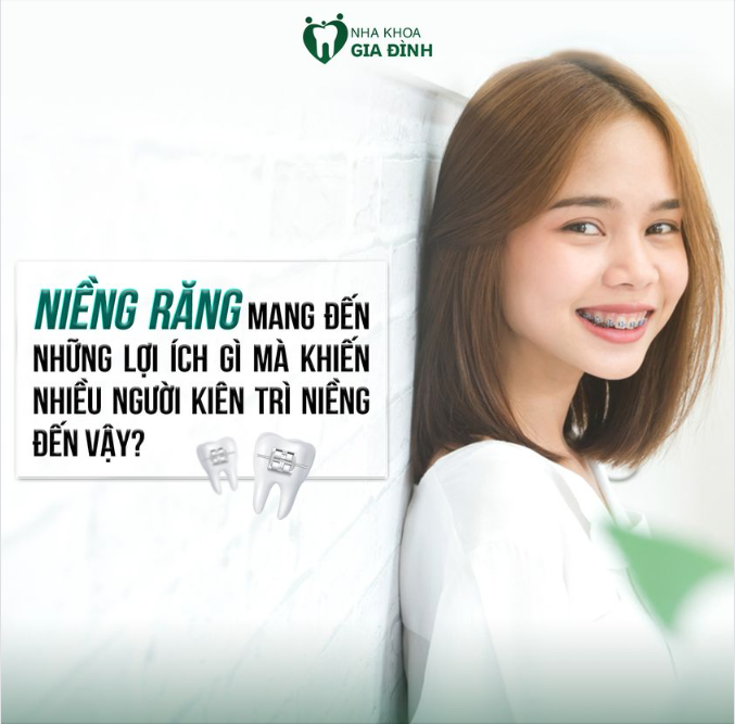 LỢI ÍCH CỦA VIỆC NIỀNG RĂNG