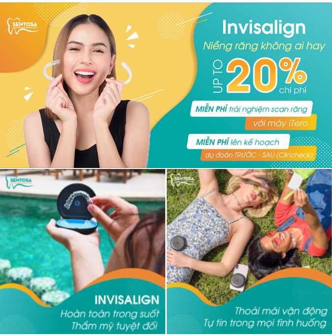 LÝ DO BẠN MUỐN NIỀNG RĂNG NHƯNG CHƯA THỰC HIỆN 