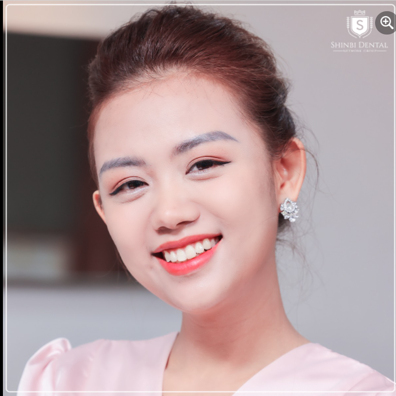 MẢI MÊ VỚI NỤ CƯỜI NGỌT NGÀO ĐẦU NẮNG HẠ