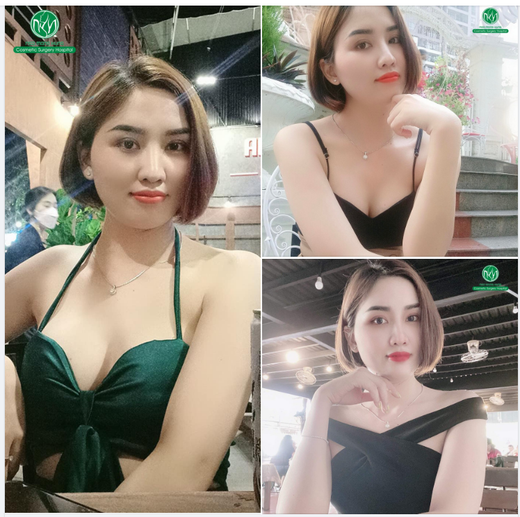 MANG LẠI VẺ ĐẸP TỎA SÁNG CHO ĐÔI MẮT