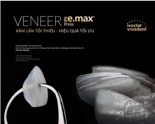 MẶT DÁN SỨ VENEER - Giải pháp đáp ứng tốt triết lý XÂM LẤN TỐI THIỂU - HIỆU QUẢ TỐI ƯU