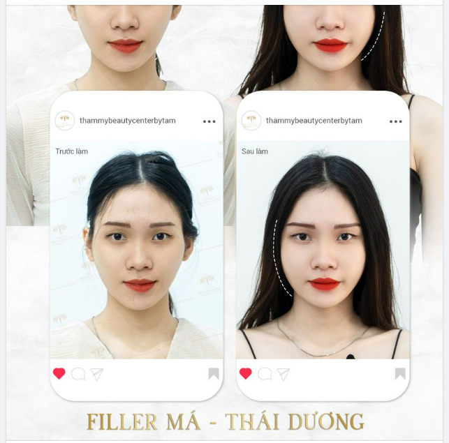 MẶT ĐẦY ĐẶN- TRỌN TƯƠI XINH
