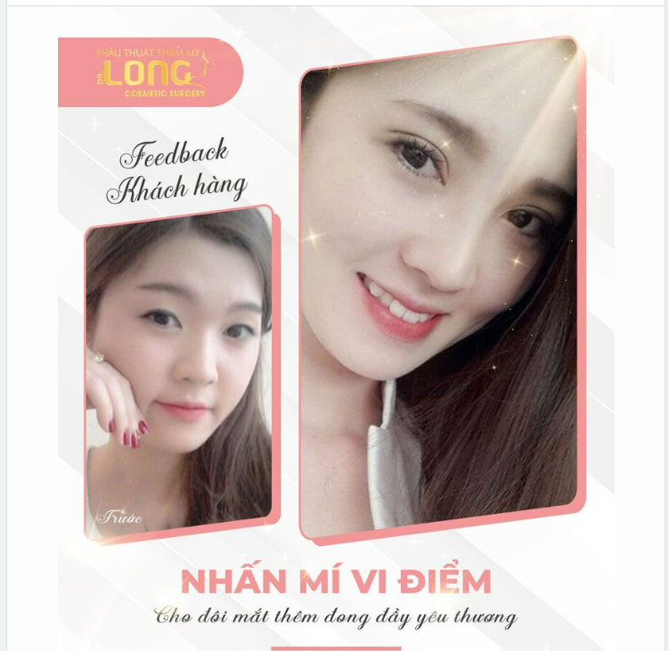 MẮT ĐẸP NHƯ THẾ NÀY LÀ VÌ ĐÂU