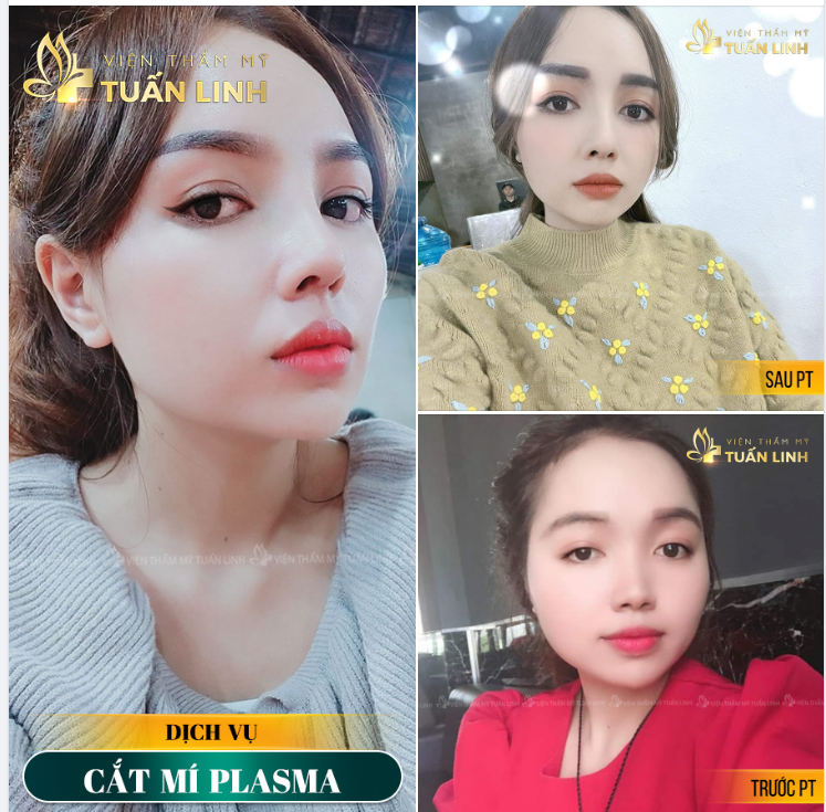 MẮT HAI MÍ ĐẸP CHUẨN MÊ LY- CÀNG NGẮM CÀNG MÊ