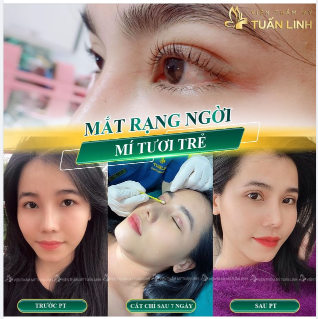 MẮT XINH - LÀ VÌ CẮT MÍ TẠI TUẤN LINH.