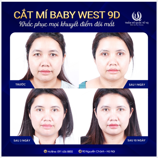 Mí đẹp xinh - Tăng thần thái - Tiếp tự tin