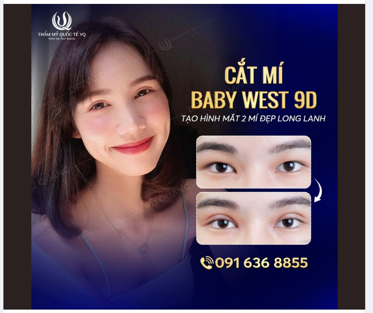 Mí xinh lung linh- Mắt đẹp có hồn  chỉ với 8,6tr.