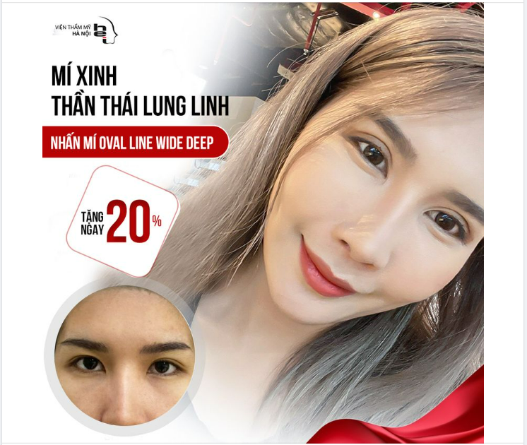 MÍ XINH - THẦN THÁI LUNG LINH