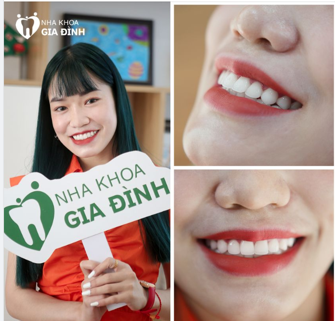 MƠ ƯỚC HÀM RĂNG TRẮNG SÁNG ĐỀU ĐẸP