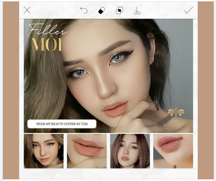 MÔI CĂNG MỌNG QUYẾN RŨ CÙNG FILLER MÔI