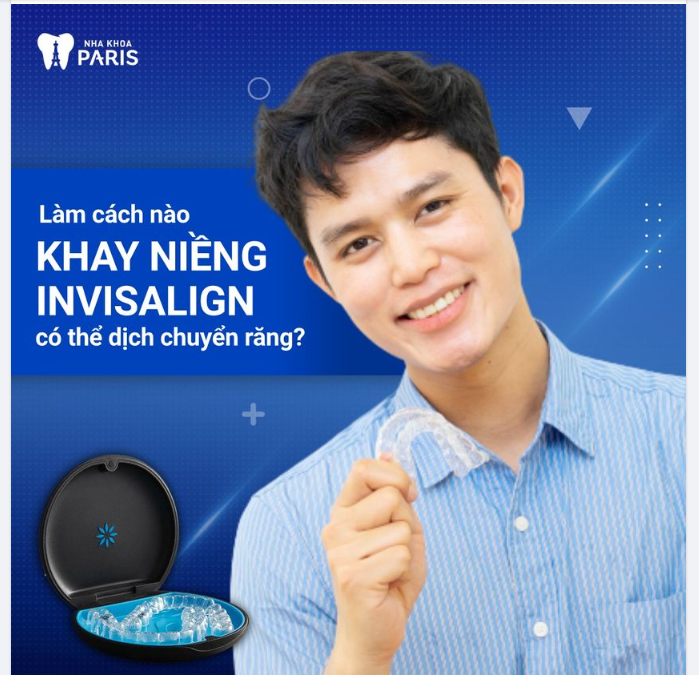 Mọi phương pháp niềng răng đều cần sử dụng lực để di chuyển răng đến vị trí khác.