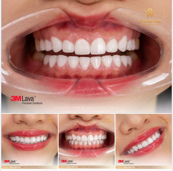 MÓN QUÀ LAVA 3M TỪ WIN SMILE - NƠI ƯỚC MƠ TỎA SÁNG THÀNH HIỆN THỰC