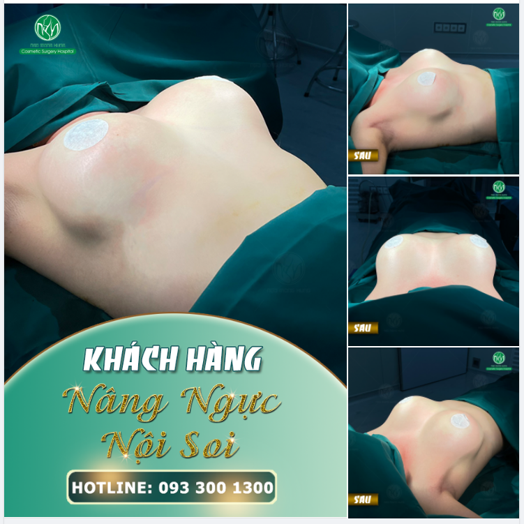 MỘT BẦU NGỰC CĂNG TRÒN ĐẾN TỪ MỘT QUYẾT ĐỊNH ĐÚNG ĐẮN