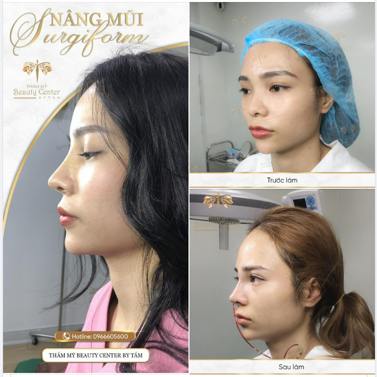 Một chút dịu dàng để mùa hè thêm rực rỡ