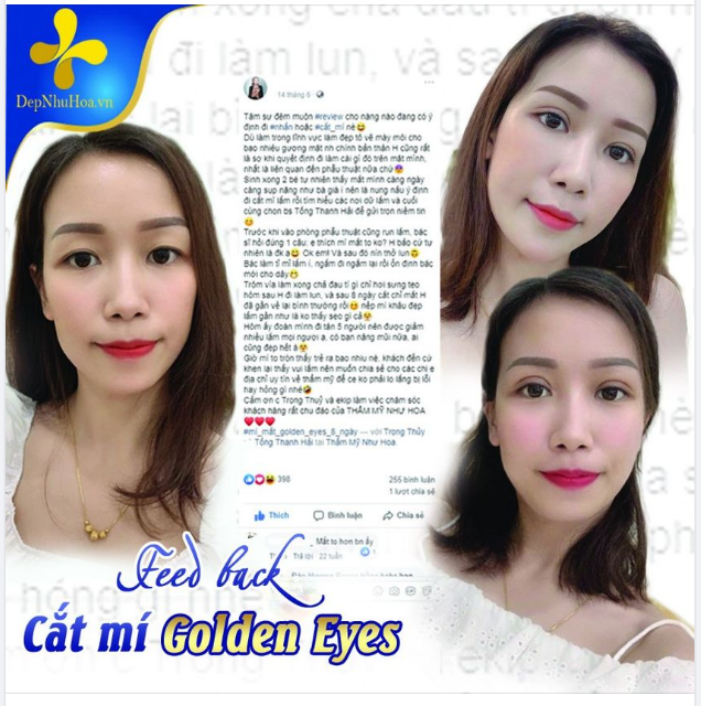 Một feedback đáng yêu, chân thật từ nữ khách hàng Cắt mí Golden Eyes tại Thẩm mỹ Như Hoa