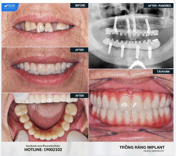 Một lựa chọn không thể tuyệt vời hơn cho người lớn tuổi