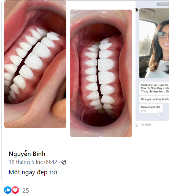Một nụ cười đẹp cũng có thể khiến cả ngày của bạn và những người xung quanh trở nên tươi đẹp hơn.