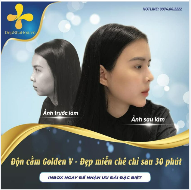 MŨI CAO, MẮT ĐẸP VẬY MÀ THỨ EM THIẾU NHẤT VẪN LÀ CẰM XINH.