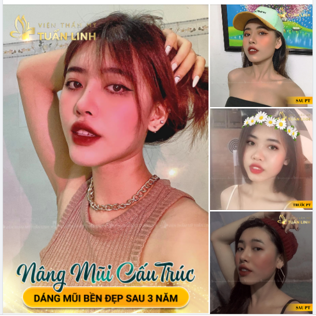 MŨI CHUẨN FORM - BỀN ĐẸP - AN TOÀN.