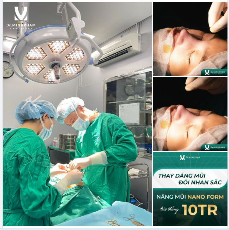 Mũi chuẩn từng ly - Dáng đẹp như ý