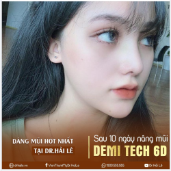 Mũi Demi Tech 6D sau 10 ngày thực hiện - Xứng đáng là dáng mũi Siêu phẩm tại Dr.Hải Lê.!!
