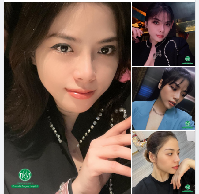 MŨI ĐẸP CHÀO HÈ SANG