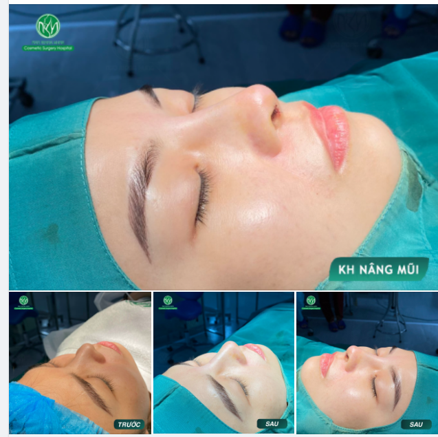 MŨI ĐẸP CHO BUỔI SÁNG THỨ 5
