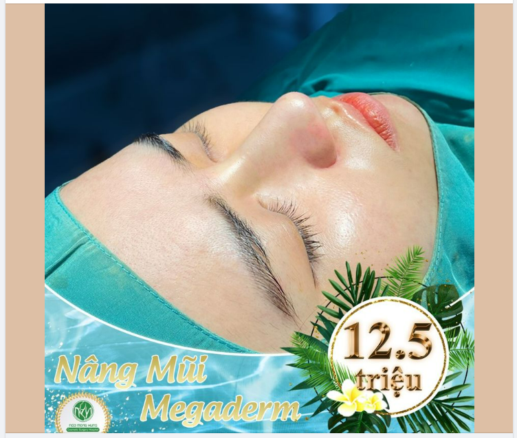 MŨI ĐẸP RẠNG RỠ - GIÁ GIẢM HẾT CỠ