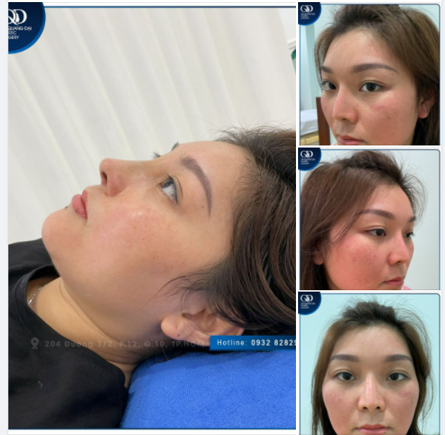 Mũi đẹp tự nhiên nhưng không tự nhiên mà đẹp
