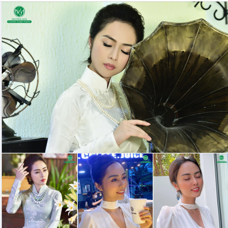 MŨI NHIỀU NĂM VẪN ĐẸP THANH THOÁT