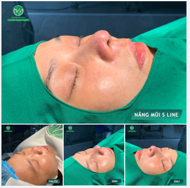 MŨI S LINE CHO BUỔI SÁNG ĐẦU NGÀY