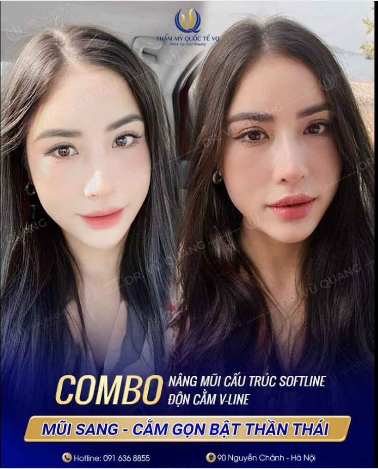 Mũi sang - Cằm gọn, bật thần thái