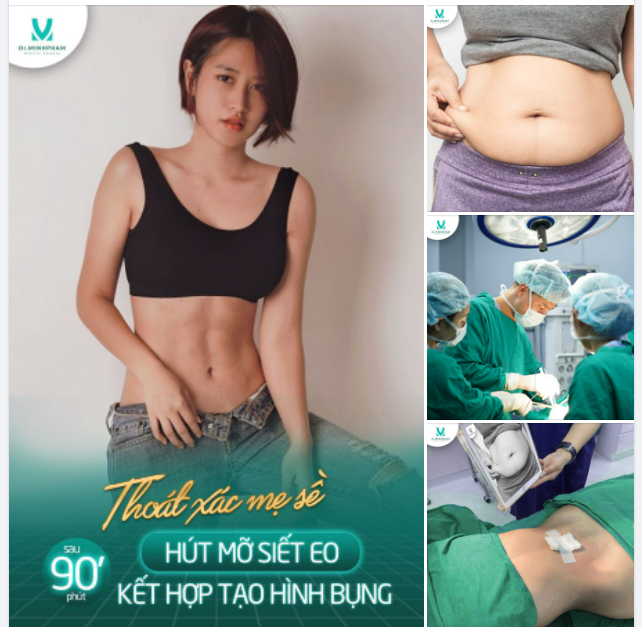 Muốn eo thon không khó - Chỉ cần có Dr. Minh Phạm