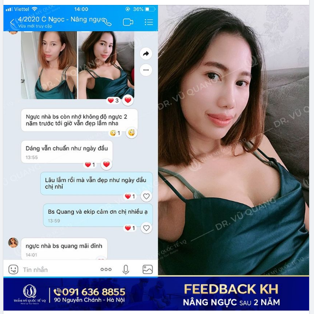 Muốn nâng ngực đẹp, phải chọn đúng Bác sĩ
