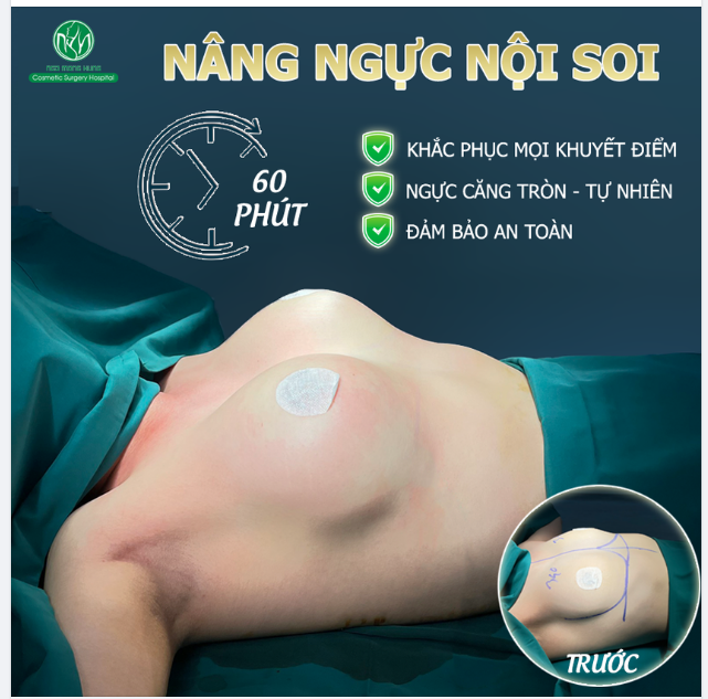 MUỐN NGỰC ĐẸP VÀ AN TOÀN ​​​​​​​ ĐẾN NGAY BVTM NGÔ MỘNG HÙNG
