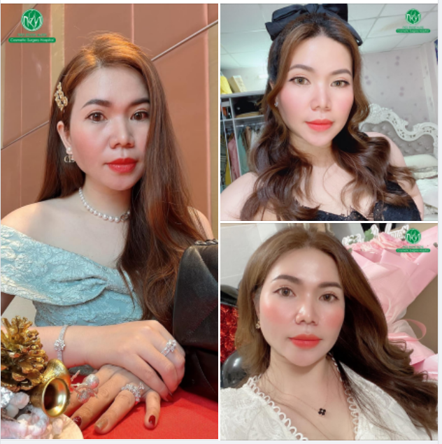 MUỐN TRẺ TRUNG VÀ XINH ĐẸP HƠN KHÔNG KHÓ!!