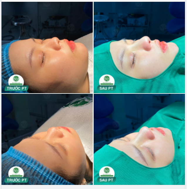 MUỐN XINH ĐẸP LÀ KHÔNG NÊN CHỜ ĐỢI