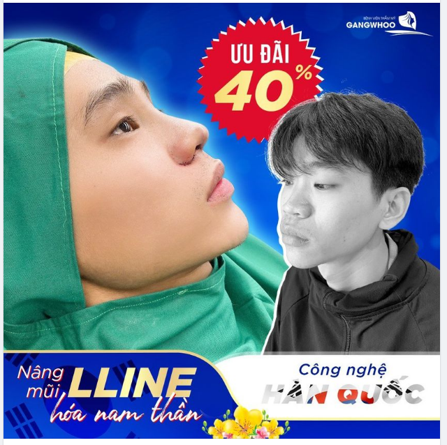 NAM GIỚI ĐẸP NHỜ NÂNG MŨI, CÓ THẬT KHÔNG