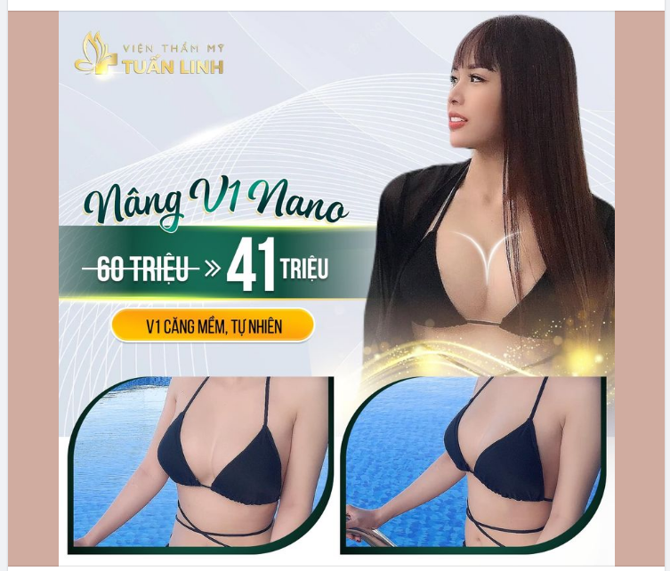 NÂNG CẤP VÒNG 1 ĐẸP QUYẾN RŨ CHỈ 41 TR CÓ TRẢ GÓP