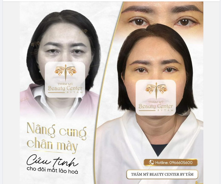 NÂNG CUNG MÀY - CỨU TINH CHO ĐÔI MẮT LÃO HÓA
