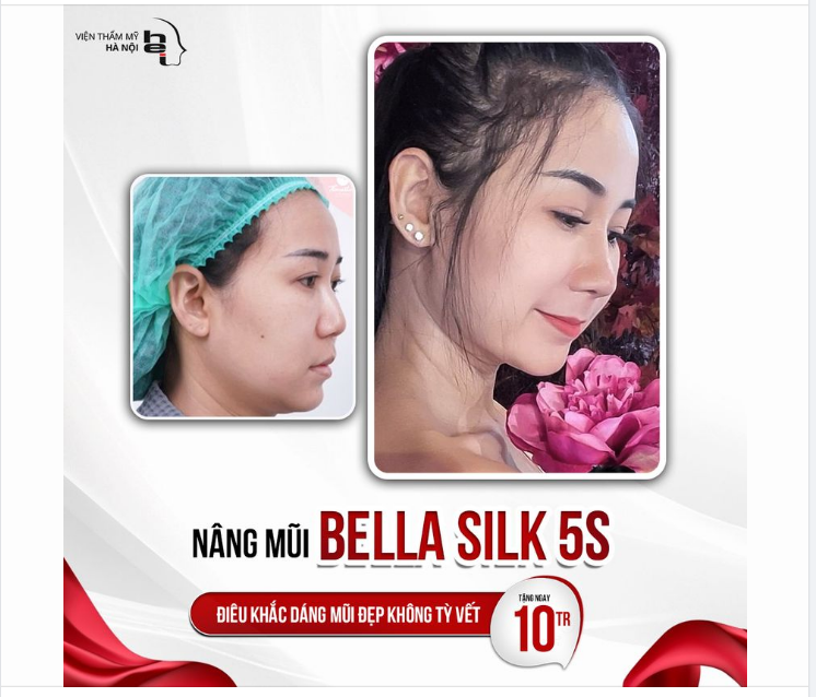 NÂNG MŨI BELLA SILK 5S - Điêu khắc dáng mũi đẹp không tỳ vết