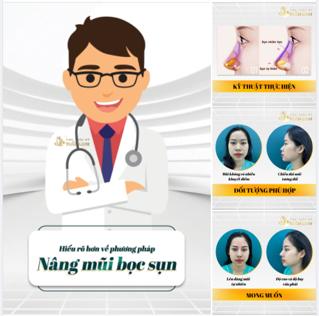 NÂNG MŨI BỌC SỤN VÀ NHỮNG ĐIỀU CẦN BIẾT