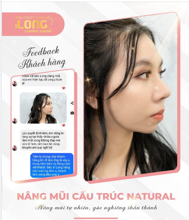 NÂNG MŨI KHÔNG NẸP - ĐẸP MỌI GÓC NHÌN