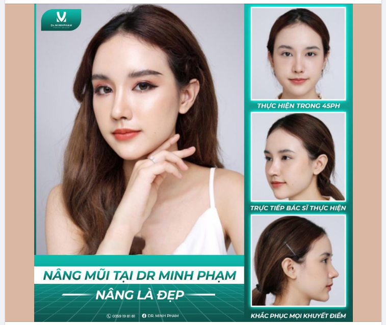 Nâng mũi Nano Form - Nâng là đẹp