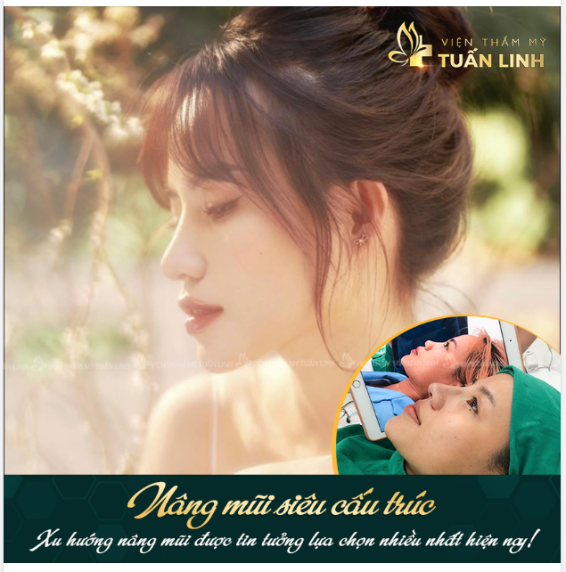 NÂNG MŨI SIÊU CẤU TRÚC - ĐỈNH CAO TẠO HÌNH MŨI