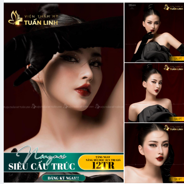 NÂNG MŨI SIÊU CẤU TRÚC