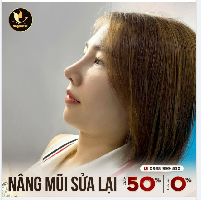 NÂNG MŨI SỬA LẠI GIẢM 50% TRẢ GÓP 0%