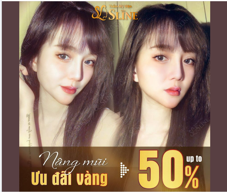 Nâng mũi ƯU ĐÃI VÀNG Nhận ngàn quà tặng